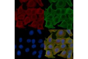 ABIN6260554 and ABIN6272679 staining Hela cells(24h of starvation treatment) by IF/ICC. (CCR10 anticorps  (C-Term))