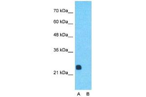Host:  Rabbit  Target Name:  RCAN1  Sample Type:  Human Fetal Muscle  Lane A:  Primary Antibody  Lane B:  Primary Antibody + Blocking Peptide  Primary Antibody Concentration:  1ug/ml  Peptide Concentration:  5ug/ml  Lysate Quantity:  25ug/lane/lane  Gel Concentration:  0. (RCAN1 anticorps  (Middle Region))