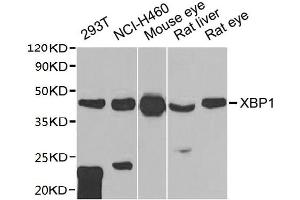 Western blot All lanes: XBP1 antibody at 1:1000 dilution Lane 1: 293T whole cell lysate Lane 2: NCI-H460 whole cell lysate Lane 3: Mouse eye tissue Lane 4: Rat liver tissue Lane 5: Rat eye tissue Secondary Goat polyclonal to rabbit IgG at 1/10000 dilution Predicted band size: 29, 41 kDa Observed band size: 41 kDa (XBP1 anticorps  (AA 1-261))