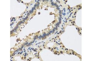 Immunohistochemistry of paraffin-embedded Rat lung using IL25 Polyclonal Antibody at dilution of 1:100 (40x lens). (IL-25 anticorps)