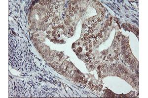 Image no. 7 for anti-Musashi Homolog 1 (Drosophila) (MSI1) antibody (ABIN1499571)