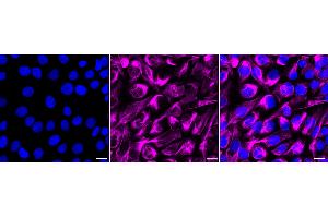 Immunocytochemical staining of HT- cells with ACAP2 antibody (ABIN7797642), 1:1,000).