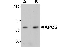 Western Blotting (WB) image for anti-Anaphase Promoting Complex Subunit 5 (ANAPC5) (Middle Region) antibody (ABIN1030862) (ANAPC5 anticorps  (Middle Region))