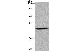 Western blot analysis of Mouse brain tissue, using ETS2 Polyclonal Antibody at dilution of 1:500 (ETS2 anticorps)