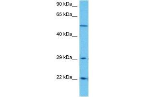 Host:  Rabbit  Target Name:  SLC25A4  Sample Tissue:  Human DLD1 Whole Cell  Antibody Dilution:  1ug/ml (SLC25A4 anticorps  (N-Term))