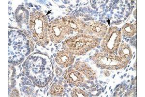 Image no. 3 for anti-Homeobox D3 (HOXD3) (AA 80-129) antibody (ABIN6735792)