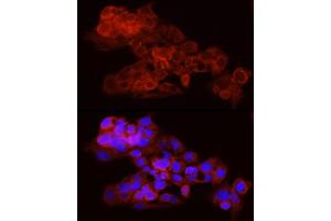 Immunofluorescence analysis of HepG2 using Vinculin Rabbit mAb (ABIN3016604, ABIN3016605, ABIN1680530 and ABIN1680531) at dilution of 1:100 (40x lens).
