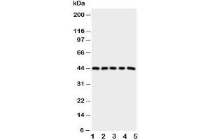 Western blot testing of PGE Receptor antibody and Lane 1:  HeLa;  2: A549;  3: MCF-7;  4: MM231;  5: MM453 cell lysate (PTGER1 anticorps  (C-Term))