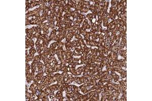 Immunohistochemical staining of human liver with PPP1R12C polyclonal antibody  shows strong cytoplasmic positivity in hepatocytes. (PPP1R12C anticorps)