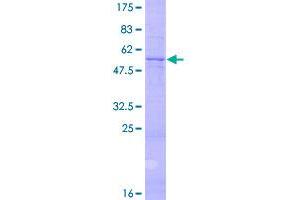 Image no. 1 for Neurotrophin 3 (NTF3) (AA 1-257) protein (GST tag) (ABIN1313101)