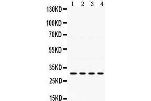 Western Blotting (WB) image for anti-Insulin-Like Growth Factor Binding Protein 3 (IGFBP3) (AA 214-252), (C-Term) antibody (ABIN3043859)