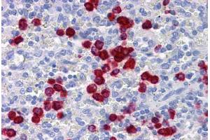 Human Spleen: Formalin-Fixed, Paraffin-Embedded (FFPE)