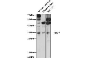 Western blot analysis of extracts of various cell lines, using ERP27 antibody (ABIN7266942) at 1000 dilution.
