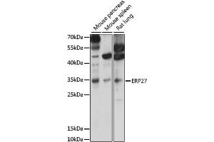 Western blot analysis of extracts of various cell lines, using ERP27 antibody (ABIN7266942) at 1000 dilution. (ERP27 anticorps  (AA 1-273))