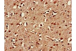 Immunohistochemistry of paraffin-embedded human brain tissue using ABIN7171556 at dilution of 1:100 (TAF1A anticorps  (AA 251-325))