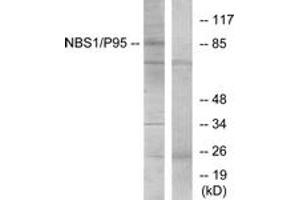 Western blot analysis of extracts from Jurkat cells, using p95/NBS1 (Ab-343) Antibody. (Nibrin anticorps  (AA 310-359))