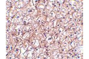 Immunohistochemistry of IFNB1 in human liver tissue with IFNB1 polyclonal antibody  at 5 ug/mL . (IFNB1 anticorps  (Internal Region))