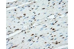 Image no. 7 for anti-Proteasome (Prosome, Macropain) 26S Subunit, ATPase, 3 (PSMC3) antibody (ABIN1501335)