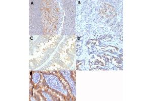 Immunohistochemical staining (Formalin-fixed paraffin-embedded sections) of human tonsil (A), human pancreas (B), human colon carcinoma (C), human rectal carcinoma (D) and human duodenum (E) with ABCC1 monoclonal antibody, clone MRP1/1343 . (ABCC1 anticorps)