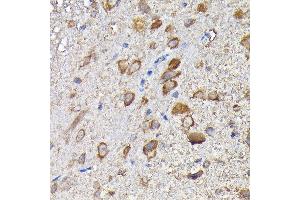 Immunohistochemistry of paraffin-embedded mouse spinal cord using MTHFD1L Rabbit pAb (ABIN6132366, ABIN6144142, ABIN6144143 and ABIN6223977) at dilution of 1:200 (40x lens). (MTHFD1L anticorps  (AA 759-978))