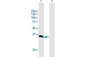 Western Blot analysis of PSMD14 expression in transfected 293T cell line by PSMD14 MaxPab polyclonal antibody. (PSMD14 anticorps  (AA 1-310))