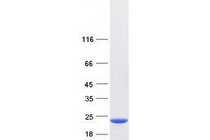 Validation with Western Blot