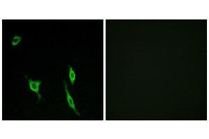 Immunofluorescence (IF) image for anti-Deleted in Colorectal Carcinoma (DCC) (Internal Region) antibody (ABIN1850423) (DCC anticorps  (Internal Region))