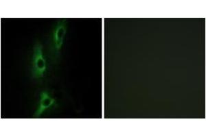 Immunofluorescence analysis of NIH-3T3 cells, using ADRB2 Antibody. (beta 2 Adrenergic Receptor anticorps  (AA 201-250))