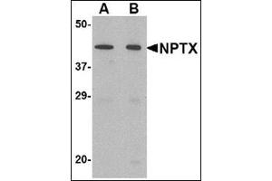 Western blot analysis of NPTX2 in mouse brain tissue lysate with this product at (A) 0. (NPTX2 anticorps  (Center))