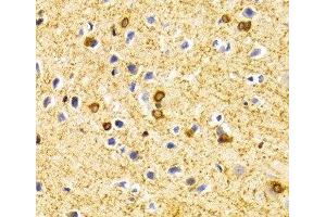 Immunohistochemistry of paraffin-embedded Rat brain using BIN1 Polyclonal Antibody at dilution of 1:100 (40x lens).
