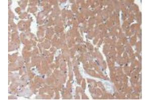 IHC-P analysis of Rat Heart Tissue, with DAB staining. (CAMK2A anticorps  (AA 1-478))