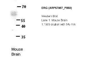 Image no. 2 for anti-ERG, ETS transcription factor (ERG) (N-Term) antibody (ABIN2787485) (ERG anticorps  (N-Term))