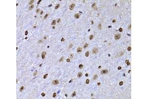 Immunohistochemistry of paraffin-embedded Mouse brain using SOX5 Polyclonal Antibody at dilution of 1:100 (40x lens).