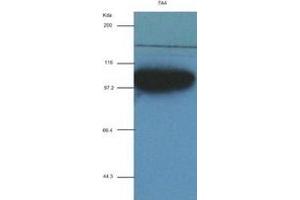 ACTN1 antibody (7A4) at 1:2000 + recombinant human ACTN1 (ACTN1 anticorps  (AA 650-893))