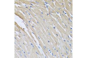 Immunohistochemistry of paraffin-embedded rat heart using CRHBP antibody (ABIN6129571, ABIN6139030, ABIN6139033 and ABIN6222243) at dilution of 1:100 (40x lens).