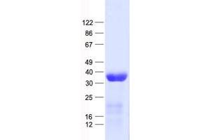 Validation with Western Blot