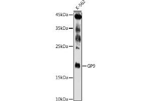 Western blot analysis of extracts of K-562 cells, using GP9 antibody (ABIN6127598, ABIN6141293, ABIN6141294 and ABIN6221019) at 1:500 dilution. (CD42a anticorps  (AA 17-147))