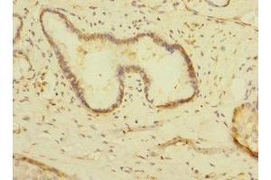 Immunohistochemistry of paraffin-embedded human pancreatic tissue using ABIN7158909 at dilution of 1:100 (MPP6 anticorps  (AA 220-420))