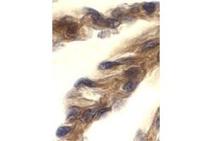 Immunohistochemistry of TRIF in human lung tissue with this product at 10 μg/ml. (TICAM1 anticorps  (C-Term))