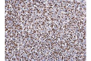 IHC-P Image ZAP70 antibody detects ZAP70 protein at nucleus on mouse lymph node by immunohistochemical analysis. (ZAP70 anticorps  (Center))