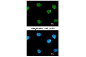 ICC/IF Image Immunofluorescence analysis of paraformaldehyde-fixed HeLa, using PARP1, antibody at 1:200 dilution.