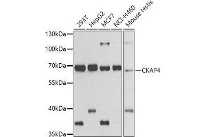 Western blot analysis of extracts of various cell lines, using CK antibody (ABIN6134474, ABIN6138645, ABIN6138646 and ABIN6223731) at 1:500 dilution. (CKAP4 anticorps)