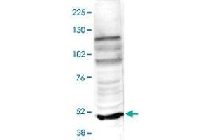 Nuclear extracts of HeLa cells (40 ug) were analysed by Western blot using TASP1 polyclonal antibody  diluted 1 : 500 in TBS-Tween containing 5% skimmed milk. (TASP1 anticorps)