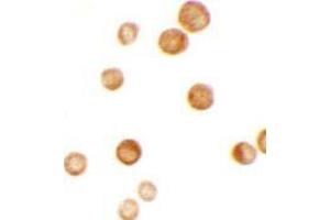 Immunocytochemistry of CASKIN2 in HeLa cells with CASKIN2 antibody at 2.