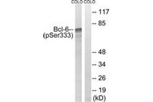 Western blot analysis of extracts from COLO205 cells treated with insulin 0. (BCL6 anticorps  (pSer333))