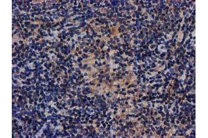 Image no. 6 for anti-V-Akt Murine Thymoma Viral Oncogene Homolog 1 (AKT1) antibody (ABIN1496559) (AKT1 anticorps)