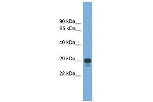WB Suggested Anti-PRRX2 Antibody Titration: 0. (PRRX2 anticorps  (Middle Region))