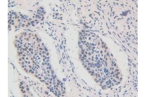 Detection of FAM19A3 in Human Lung Tissue using Polyclonal Antibody to Family With Sequence Similarity 19, Member A3 (FAM19A3)