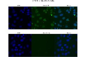 Sample Type :  SKOV3   Primary Antibody Dilution:  4 ug/ml   Secondary Antibody :  Anti-rabbit Alexa 546   Secondary Antibody Dilution:  2 ug/ml   Gene Name :  CPSF6