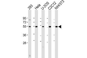 All lanes : Anti-Vimentin Antibody (S82) at 1:1000 dilution Lane 1: 293 whole cell lysate Lane 2: Hela whole cell lysate Lane 3: U-2OS whole cell lysate Lane 4: C2C12 whole cell lysate Lane 5: NIH/3T3 whole cell lysate Lysates/proteins at 20 μg per lane. (Vimentin anticorps  (AA 63-90))